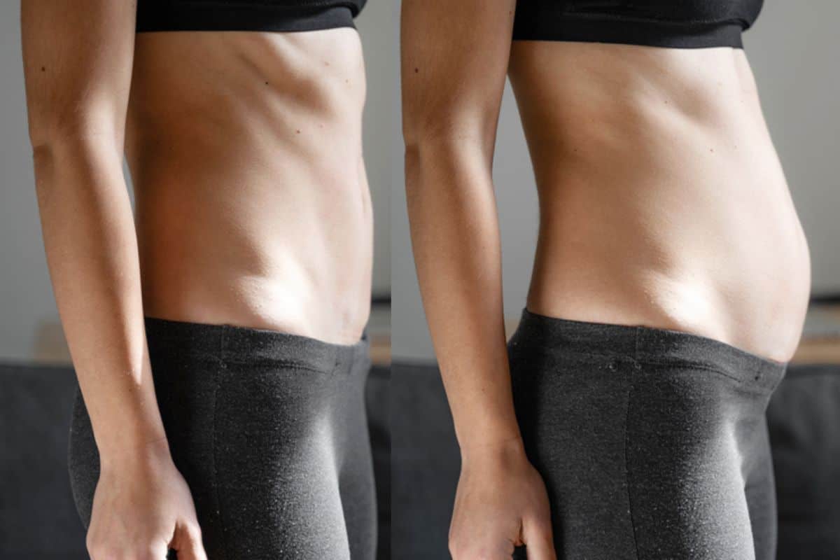 How long does diastasis recti take to improve Lower Place?