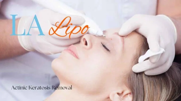 Woman receiving Actinic Keratosis Removal Treatment Lower Place