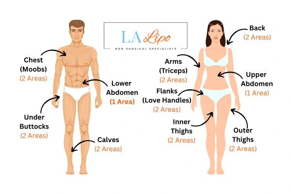 LA LIPO Cryolipolysis Areas Lower Place