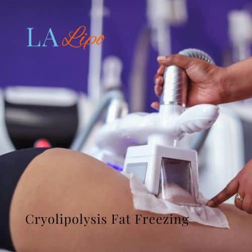 fat freezing - Cryolipolysis Lower Place