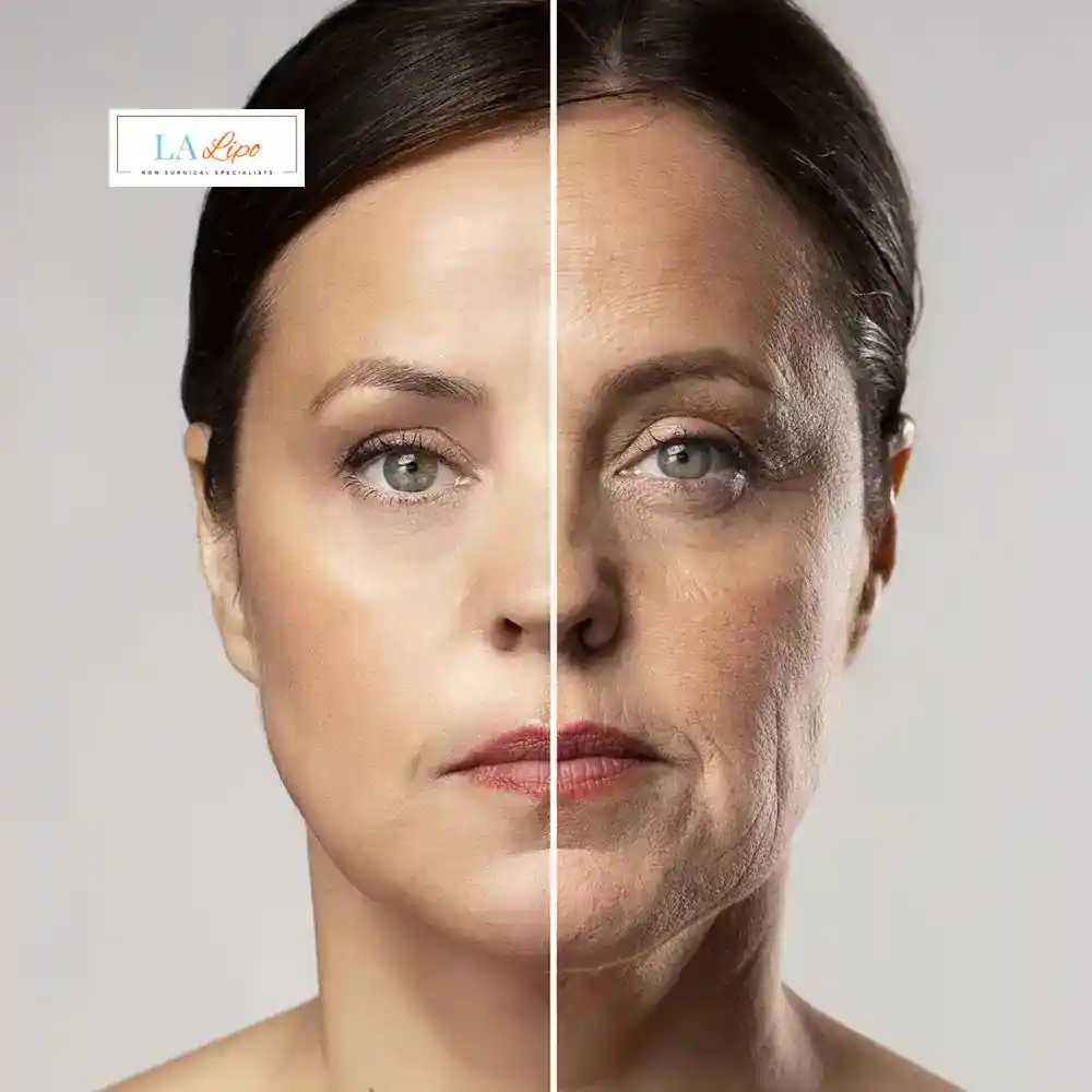 How Can You Tell If Non-Surgical Skin Tightening Is Right for You Lower Place?