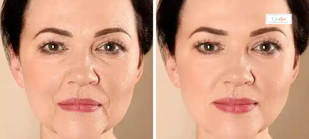Why Aren’t My Skincare Products Making My Sagging Skin Look Firmer Lower Place?